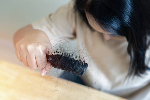 istock oung Asian woman with comb and problem hair on light beige background. 1493075513