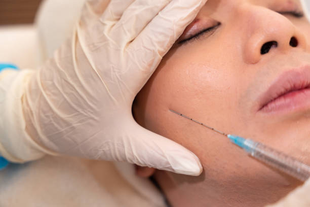 istock An young asian male is having a injection in a beauty centre 1493079942