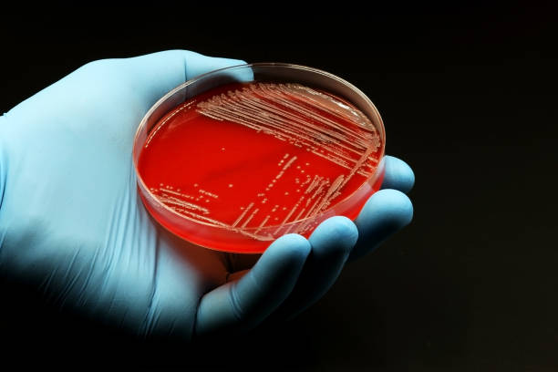 перчатка врача или ученого с чашкой петри со средой «агар-кровь» с культурой бактерий метициллин-резистентного золотистого стафилококка (m - agar jelly стоковые фото и изображения