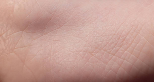istock Texture of wrinkled skin 1493257777
