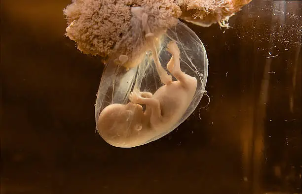Photo of human embryo