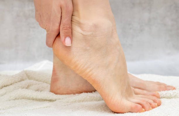 istock woman callus on feet 1493430979