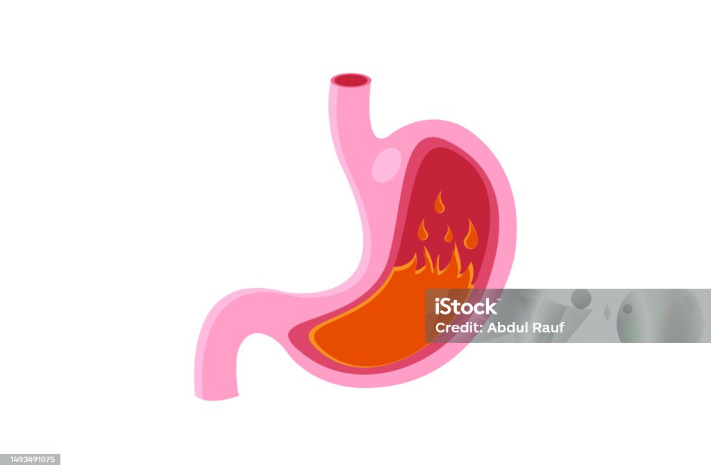 Pyrosit Form Web Stock Illustration - Download Image Now - Abdomen, Acid, Adult - iStock