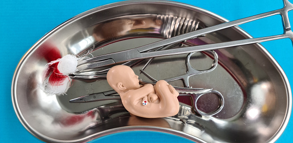 Abortion concept with baby fetus and medical tool. Termination of pregnancy and stress