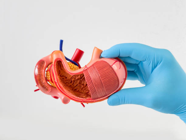 istock Doctor holding a human stomach 1493684455