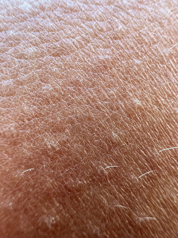 Skin close up with wrinkles and dryness