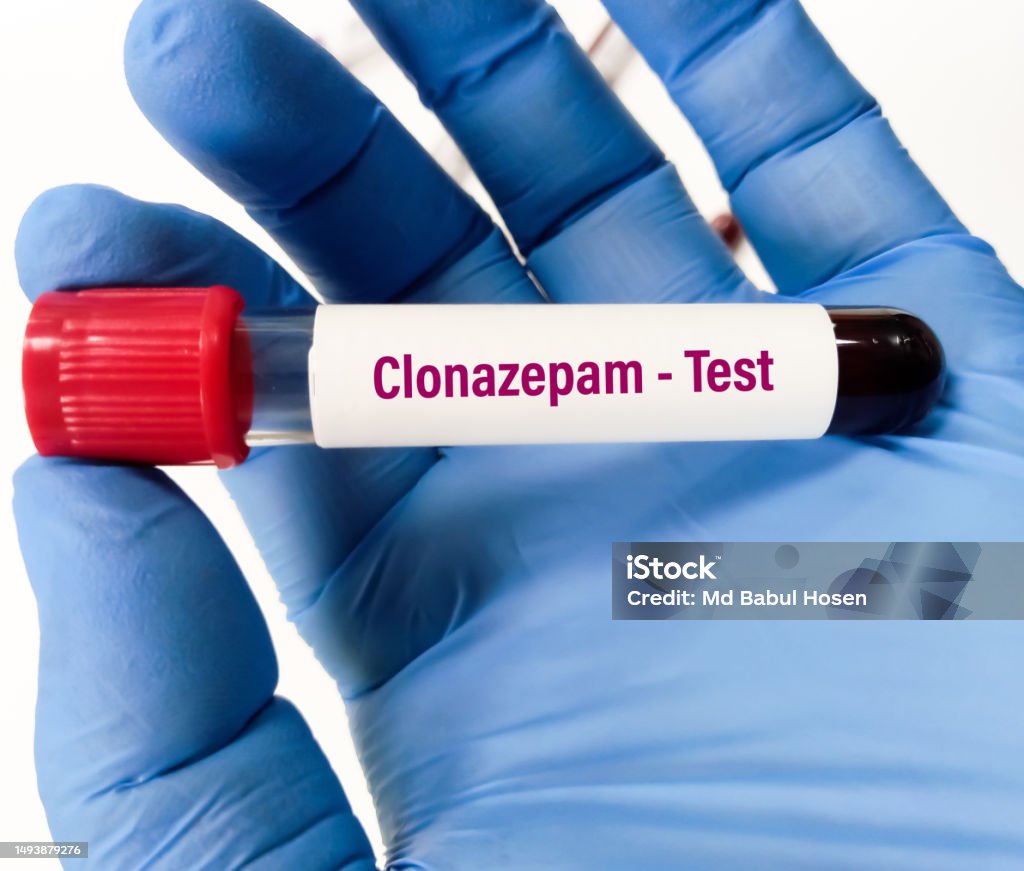 Blood Sample For Serum Clonazepam Label Test To Set Therapeutic Range Blood Sample For Serum Clonazepam Label Test To Set Therapeutic Range