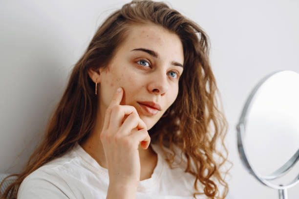 istock Beautiful woman with problem skin looking into mirror. Dermatology. 1493938619