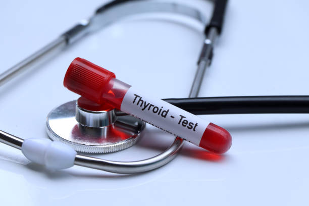 istock Thyroid test to look for abnormalities from blood 1493954339