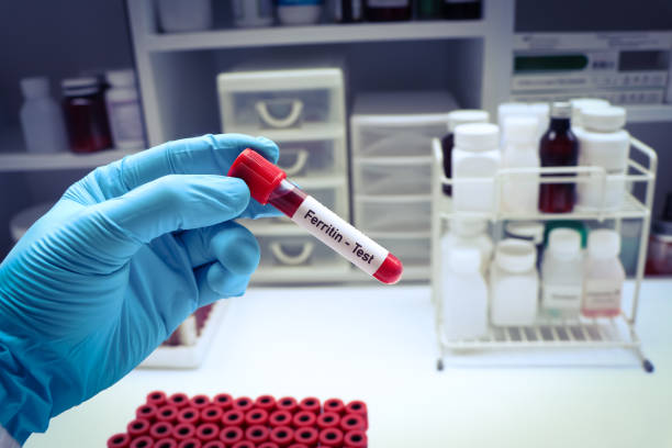 istock ferritin test to look for abnormalities from blood 1493954532