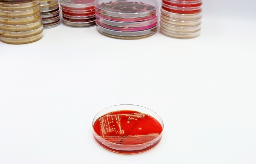 A Petri dish with Agar-Blood medium with a culture of the bacteria Methicillin-resistant Staphylococcus aureus (MRSA)