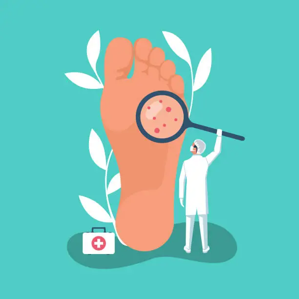 Vector illustration of Podiatry concept. Landing Page feet treatment. Vector flat.