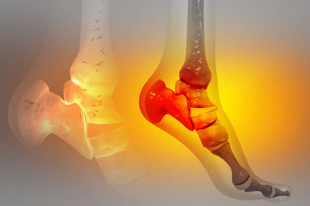 istock Bones of the human foot. Ankle pain. Ankle injury. 3d illustration 1494526708