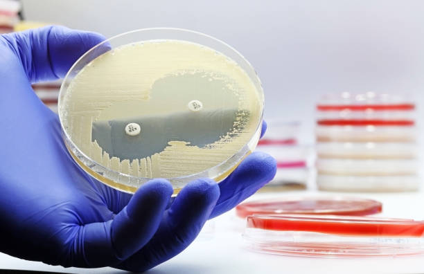 항생제 내성 검사가 수행된 박테리아가 있는 미생물 배양 페트리 접시를 보여주는 과학자 또는 의사의 손 - fecal coliform bacteria 뉴스 사진 이미지