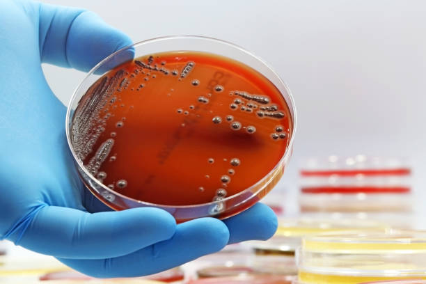 미생물학 실험실의 페트리 접시에서 자라는 박테리아 종의 갈색 군체. - fecal coliform bacteria 뉴스 사진 이미지