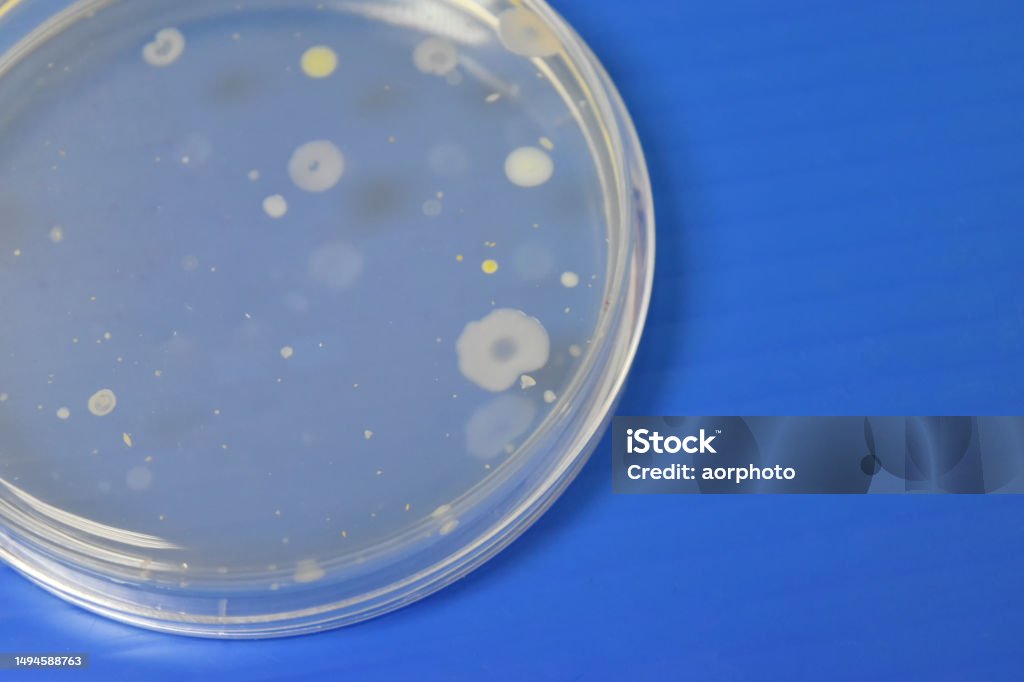 Lab Colonies Colonies Of Bacteria Growth On Agar Plate Medium In Laboratory Stock ...