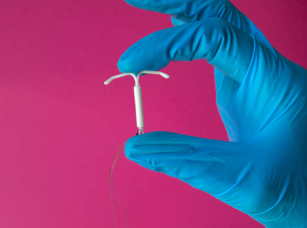 Hormonal IUD (intrauterine device or coil) stock photo