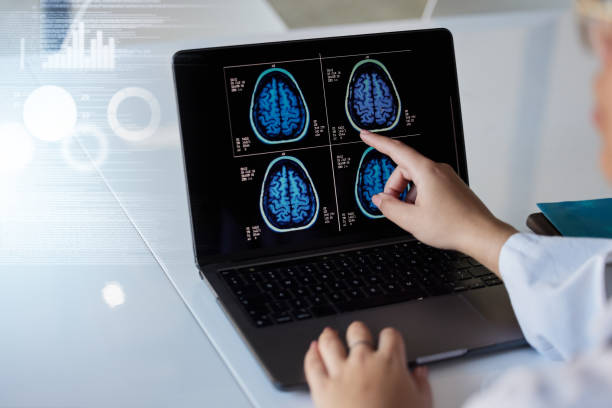 istock Brain x ray, computer results and doctor hands with digital report graphic about neurology. Anatomy, xray and assessment data with a healthcare employee with mri test information in a hospital 1494750904