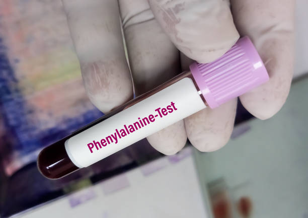 페닐케톤뇨증(pku) 진단을 위한 페닐알라닌 검사를 위한 혈액 샘플. 신생아의 유전 장애. - pku 뉴스 사진 이미지