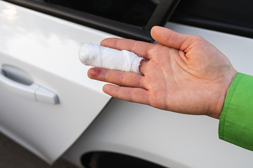 A man shows a hand with a bandaged finger against the background of an ajar car door, a concept on the topic of injury by negligence, pinched his hand by the door