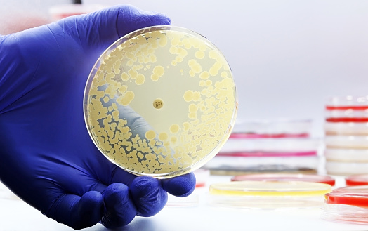 The rise of antibiotic-resistant bacterial infections. Super bugs. A microbiological culture Petri dish with bacteria and an antibiotic resistance test