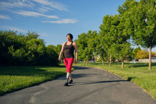 istock Woman with Prosthetic Leg in a Park 1495168366