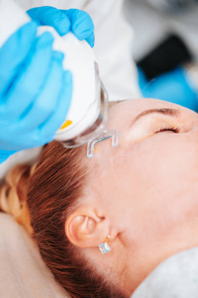 istock Laser skin resurfacing procedure 1495182685