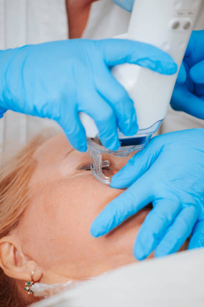 istock The ablative laser removes the thin outer layer of the skin, the epidermis 1495182844