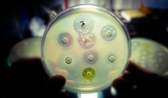 Antimicrobial susceptibility testing in petri dish. Microbiologist check Antibiotic resistance of bacteria