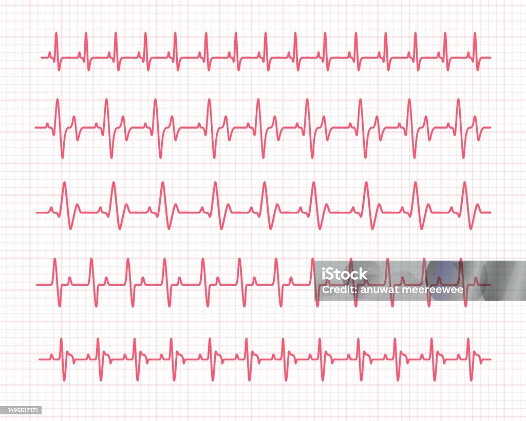 Cardian Rythm Heart Rhythm Graph Checking Your Heartbeat For Diagnosis Stock ...