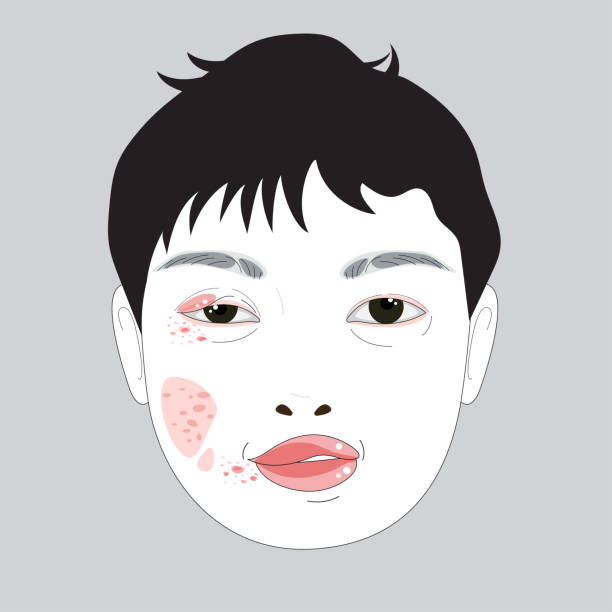 Eye Sweilling Animation 60+ Swollen Eyes Cartoons Stock Photos, Pictures & Royalty-Free Images ...