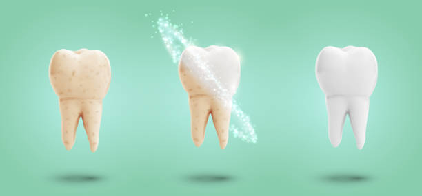 ilustrações de stock, clip art, desenhos animados e ícones de vector set of three molars. tooth cleaning, care and protection - equal opportunity flash