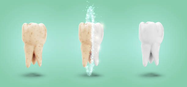 illustrazioni stock, clip art, cartoni animati e icone di tendenza di insieme vettoriale di tre molari. pulizia, cura e protezione dei denti - equal opportunity flash