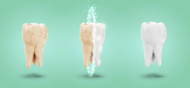 ilustrações de stock, clip art, desenhos animados e ícones de vector set of three molars. tooth cleaning, care and protection - equal opportunity flash