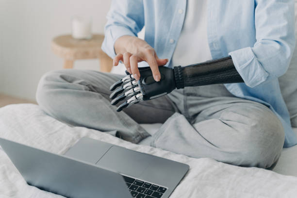 istock Handicapped woman with artificial arm working on laptop at home. Setting up bionic prosthesis. 1495646421