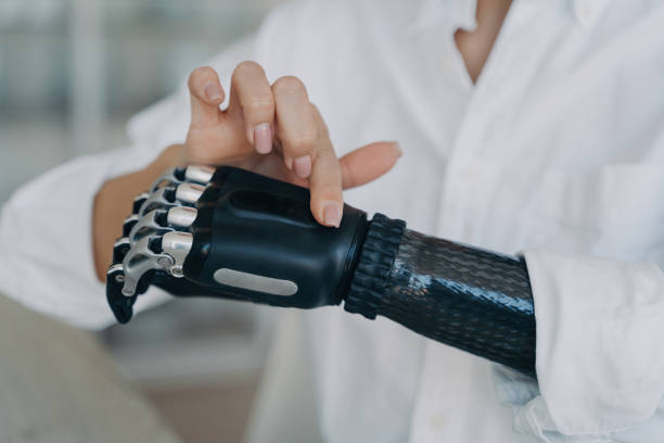 istock Hands of handicapped girl. Cyber prosthesis hand has processor chip, software and buttons. 1495646468