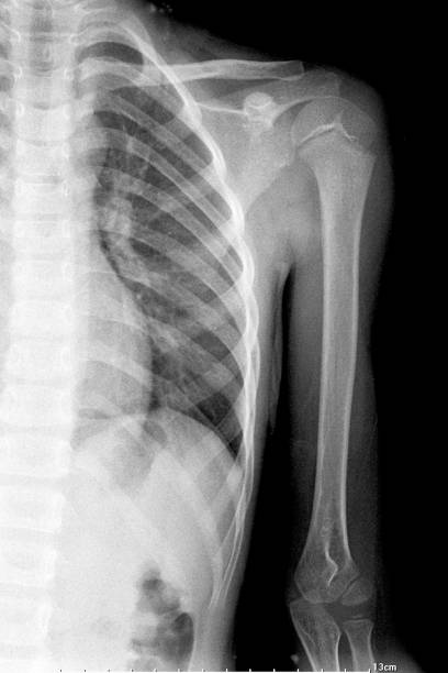 istock CONVENTIONAL RADIOLOGICAL RADIOLOGICAL PHOTOS 1495816995