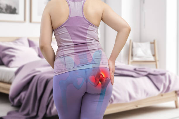douleurs articulaires à la hanche, femme souffrant d’arthrose à la maison - human muscle buttocks sport surgery photos et images de collection