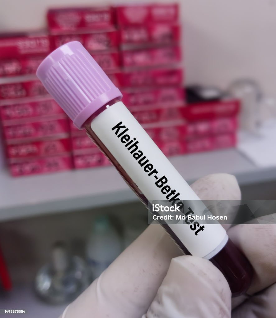 Kleihauerbetke Test Or Kleihauer Test Is Utilized To Determine If There Kleihauerbetke Test Or Kleihauer Test Is Utilized To Determine If There