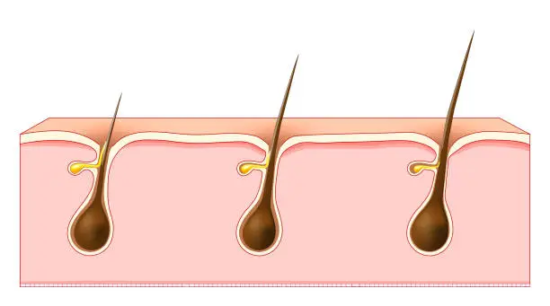 Vector illustration of Hair growth. Cross section of a human skin with Hair follicles.