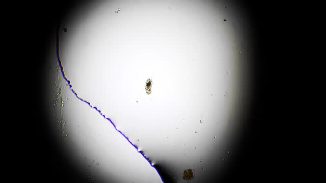 Microscopic footage of rotifer moving in fresh water sample with high magnification