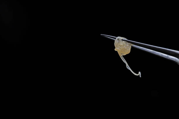 istock Anisakis. The tip of a surgical forceps holding parasitic fish worms 1496028871