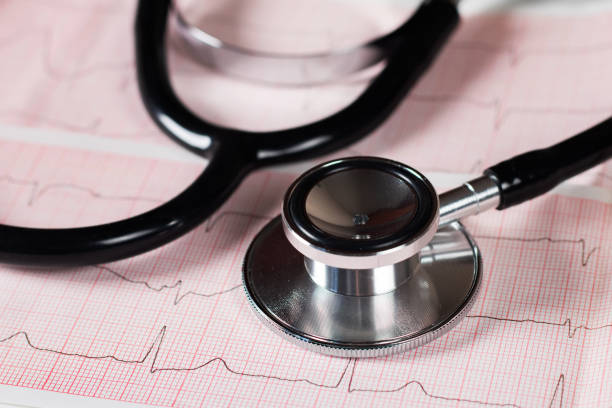 istock Medical concept. Cardiogram with stethoscope on table, closeup. 1496065520