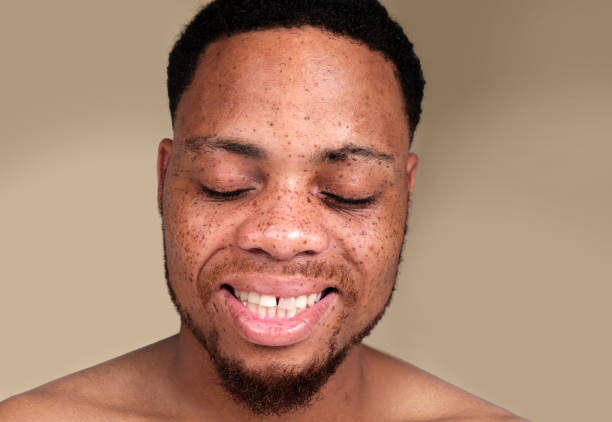 istock Studio portrait of a man with freckles smiling - backdrop 1496345230