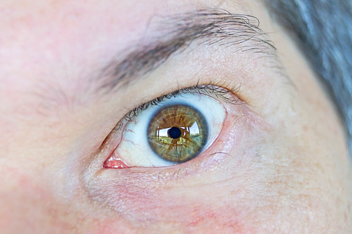 Detail of a man's left greenish-brown eye with an apprehensive expression
