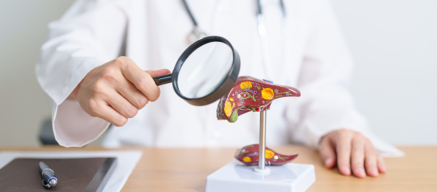 Doctor with human Liver model and Magnifying glass. Liver cancer and Tumor, Jaundice, Viral Hepatitis A, B, C, D, E, Cirrhosis, Failure, Enlarged, Hepatic Encephalopathy and Ascites Fluid in Belly