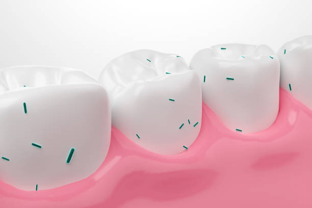 istock Bacteria sticking on tooth and gums 1496589884