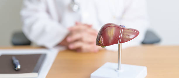 dokter dengan model anatomi hati manusia. kanker hati dan tumor, penyakit kuning, virus hepatitis a, b, c, d, e, sirosis, kegagalan, membesar, ensefalopati hepatik, asites cairan dalam perut dan konsep kesehatan - hepatitis potret stok, foto, & gambar bebas royalti