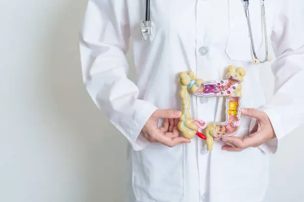 Photo of Doctor holding human Colon anatomy model. Colonic disease, Large Intestine, Colorectal cancer, Ulcerative colitis, Diverticulitis, Irritable bowel syndrome, Digestive system and Health concept