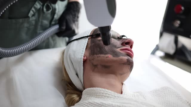 Beautician performs a carbon fiber based skin exfoliation treatment. The cosmetologist administers the carbon face peeling procedure, utilizing specialized equipment for effective results.